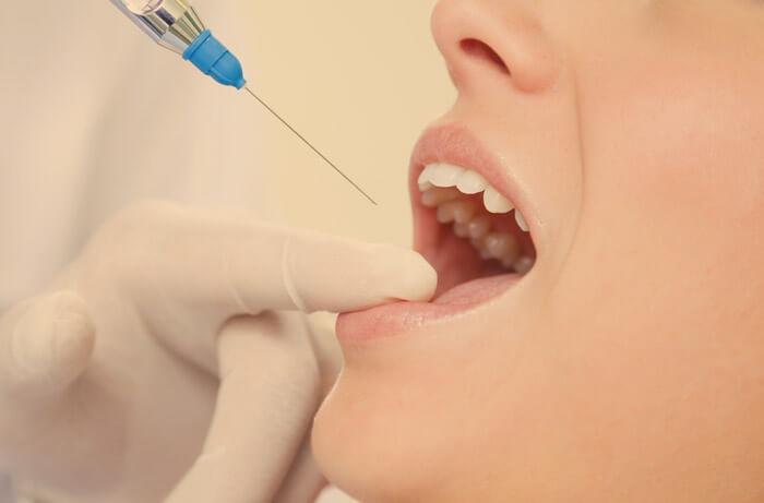 cirugía oral anestesia