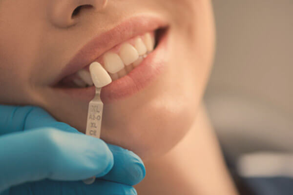 Implantología-dientes-artificiales-fijos