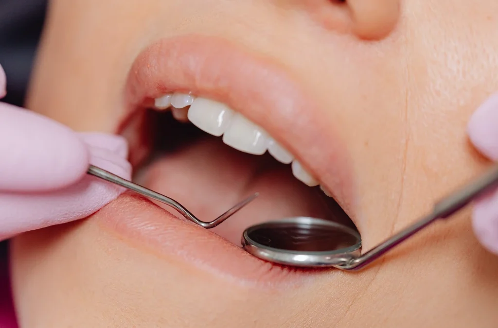 ¿Duelen los implantes dentales?