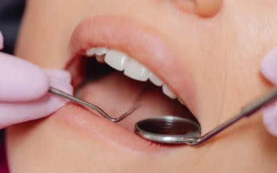 ¿Duelen los implantes dentales?