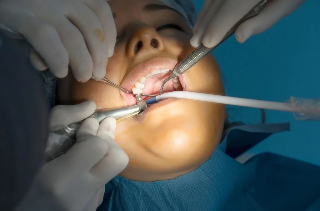 Consejos después de una cirugía de implante dental