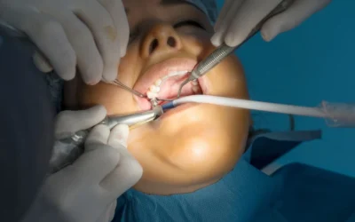 Consejos después de una cirugía de implante dental