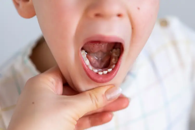 Dentista en Astigarraga para niños | Clínica dental Astigarraga