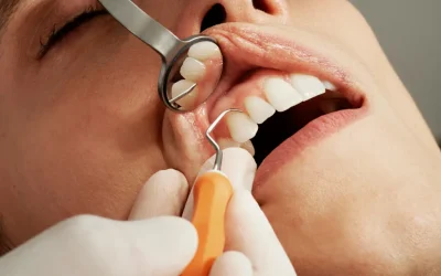 Diente roto: qué hacer según el tipo de fractura