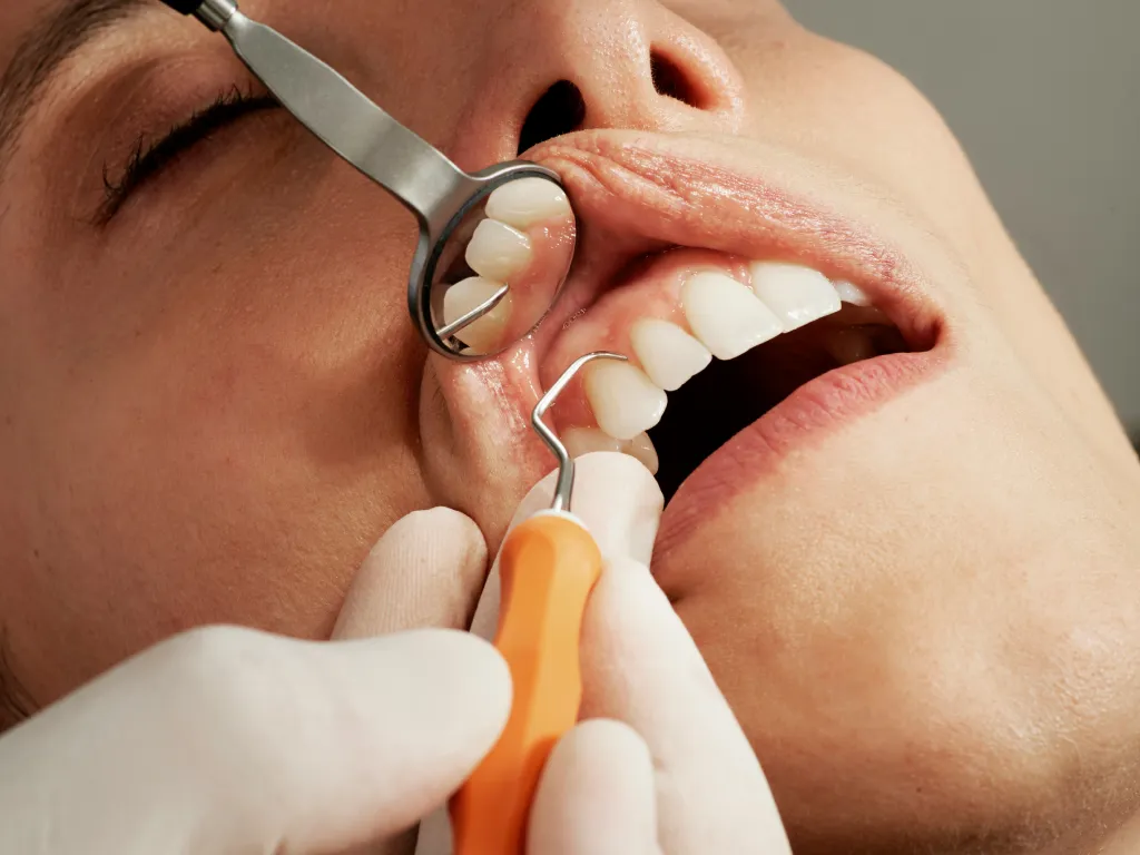Diente roto que hacer | Clínica dental Astigarraga 
