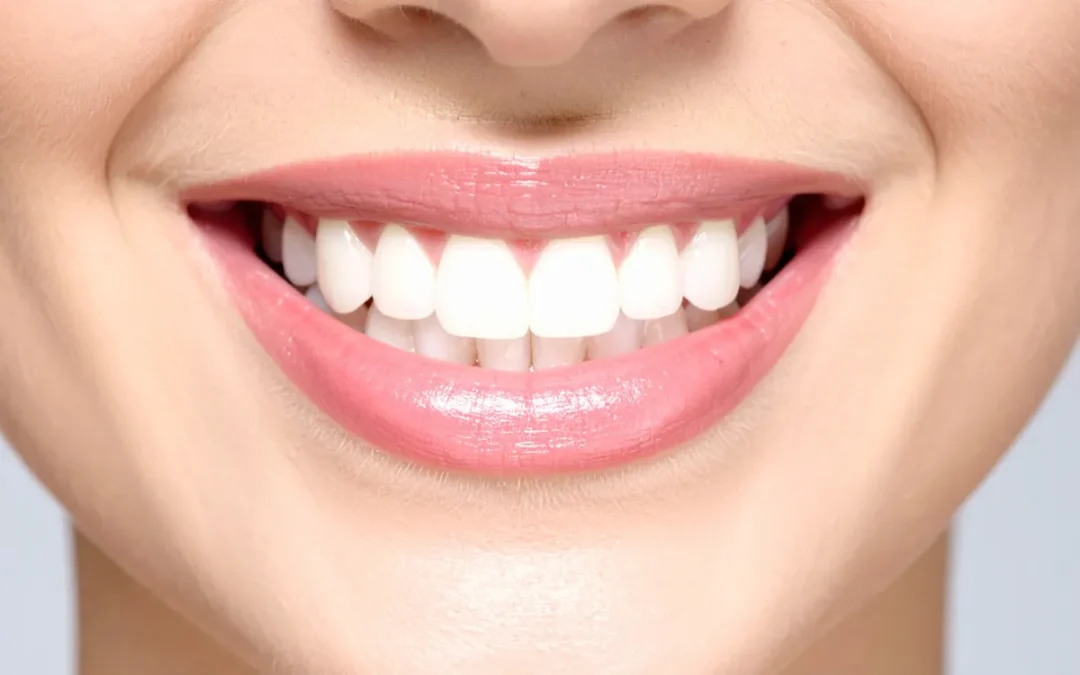 Dientes amarillos: causas y tratamiento