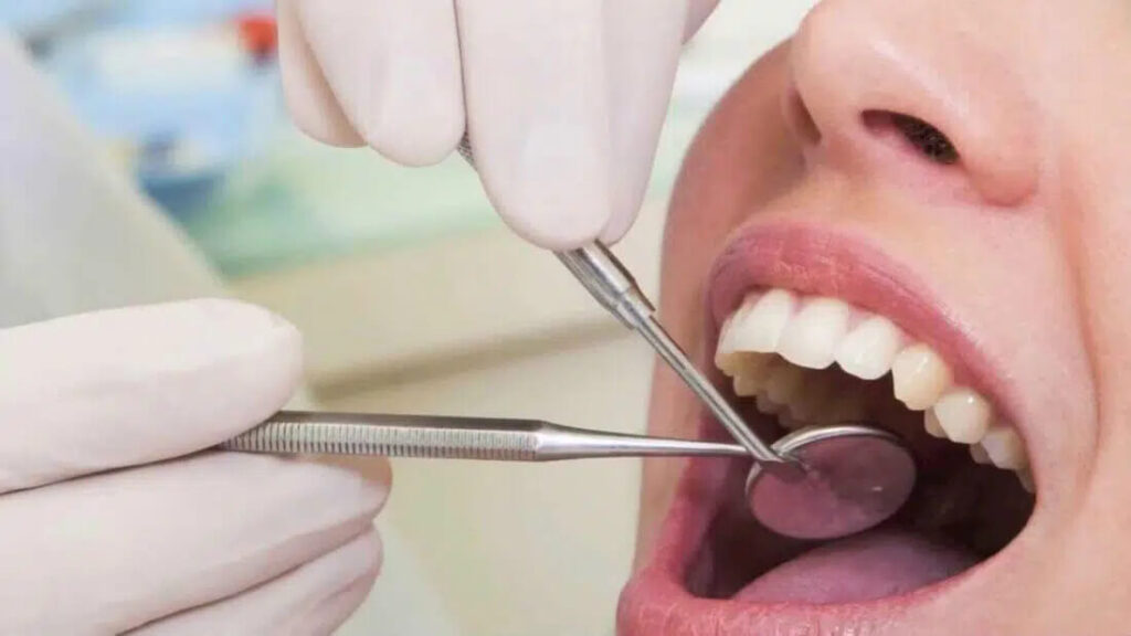 Empaste dental resina