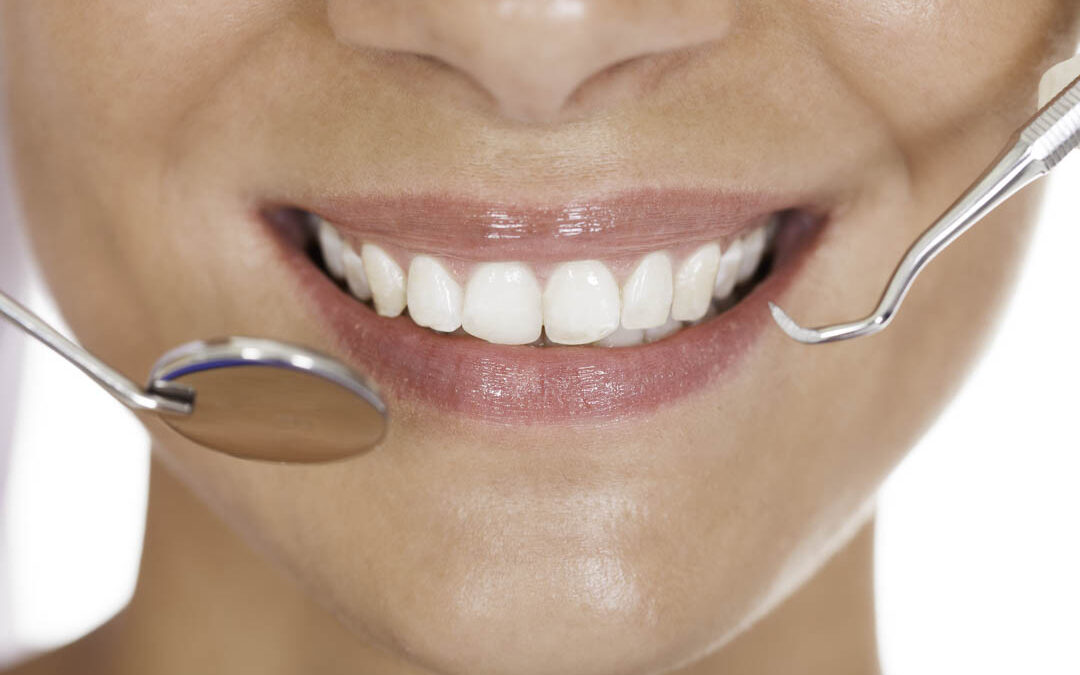 ¿Por qué salen las caries?