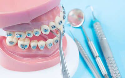 7 fases del tratamiento de ortodoncia