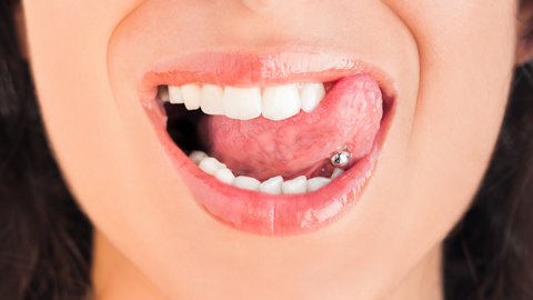 Encías retraídas por piercing en la lengua
