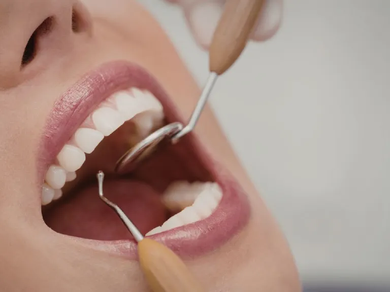 sensibilidad dental