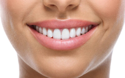 Limpieza dental: conoce los mitos