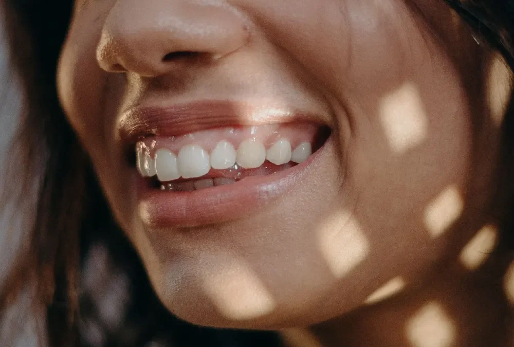 Sonrisa gingival: por qué se ve demasiado la encía y cómo se trata