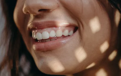 Sonrisa gingival: por qué se ve demasiado la encía y cómo se trata