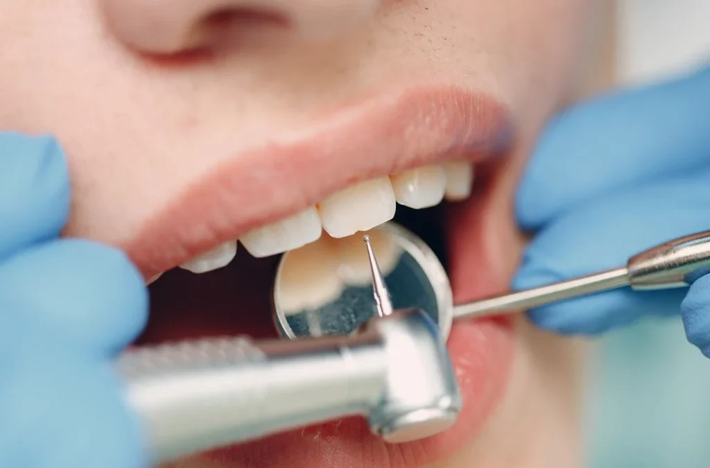 Urgencia dental en verano: cuándo llamar al dentista y qué hacer mientras esperas