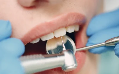 Urgencia dental en verano: cuándo llamar al dentista y qué hacer mientras esperas